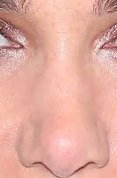 50. On a scale of 1-10, How good-looking is this nose?