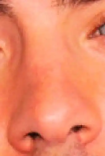 9. On a scale of 1-10, how attractive is this nose?