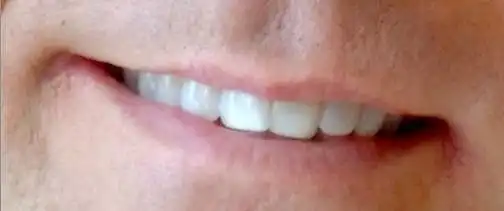 30. On a scale of 1-10, How good-looking are these lips?