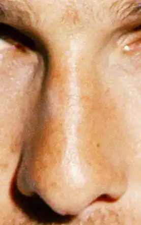 6. On a scale of 1-10, how attractive is this nose?