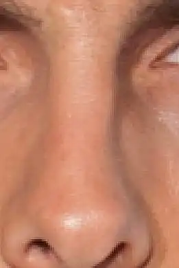 14. On a scale of 1-10, How good-looking is this nose?