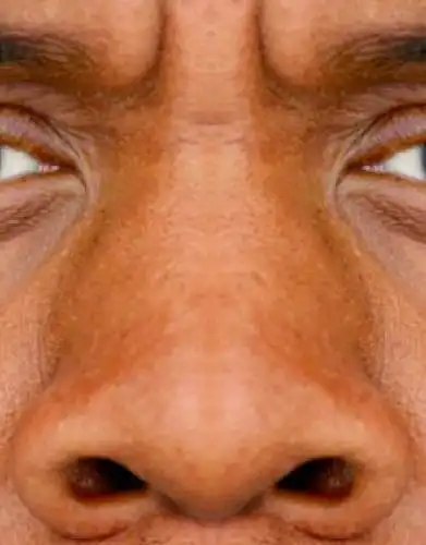 13. On a scale of 1-10, How good-looking is this nose?