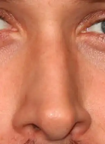 18. On a scale of 1-10, How good-looking is this nose?
