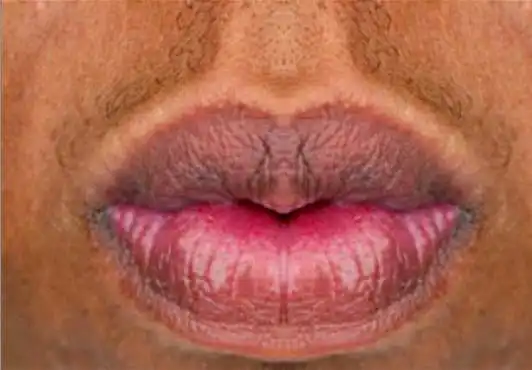 3. Auf einer Skala von 1-10, wie gut aussehend sind diese Lippen?