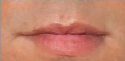 4. Auf einer Skala von 1-10, wie gut aussehend sind diese Lippen?