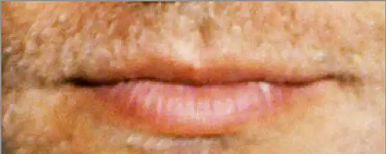 6. Auf einer Skala von 1-10, wie gut aussehend sind diese Lippen?