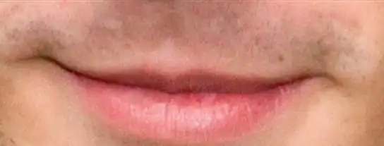 7. Auf einer Skala von 1-10, wie gut aussehend sind diese Lippen?