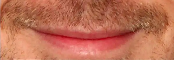 8. Auf einer Skala von 1-10, wie gut aussehend sind diese Lippen?