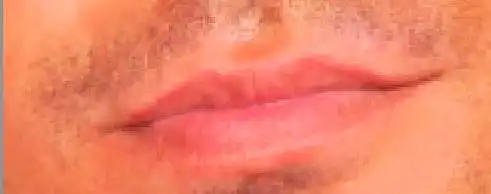 9. Auf einer Skala von 1-10, wie gut aussehend sind diese Lippen?