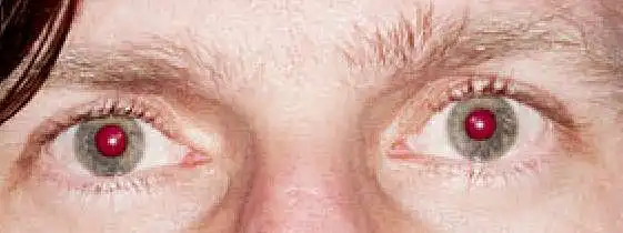 1. En una escala del 1 al 10, ¿qué tan atractivos son estos ojos?