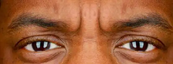 3. En una escala del 1 al 10, ¿qué tan atractivos son estos ojos?