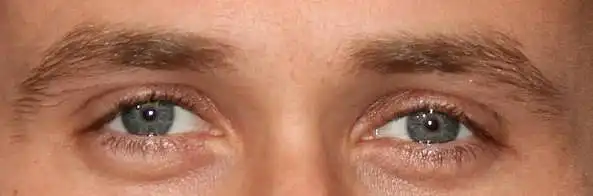 8. Sur une échelle de 1 à 10, à quel point ces yeux sont-ils beaux ?