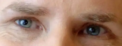 10. En una escala del 1 al 10, ¿qué tan atractivos son estos ojos?