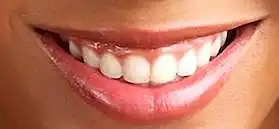 52. En una escala del 1 al 10, ¿qué tan atractivos son estos labios?